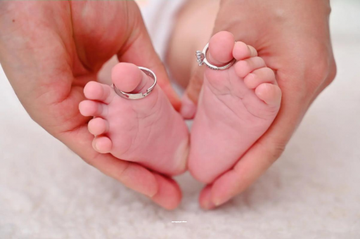 石狮宝宝有痱子怎么办